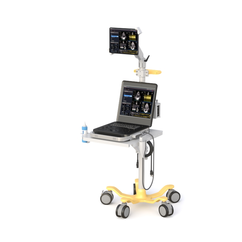 Ergonomic Mobile Medical Laptop & Monitor Cart - Image 6